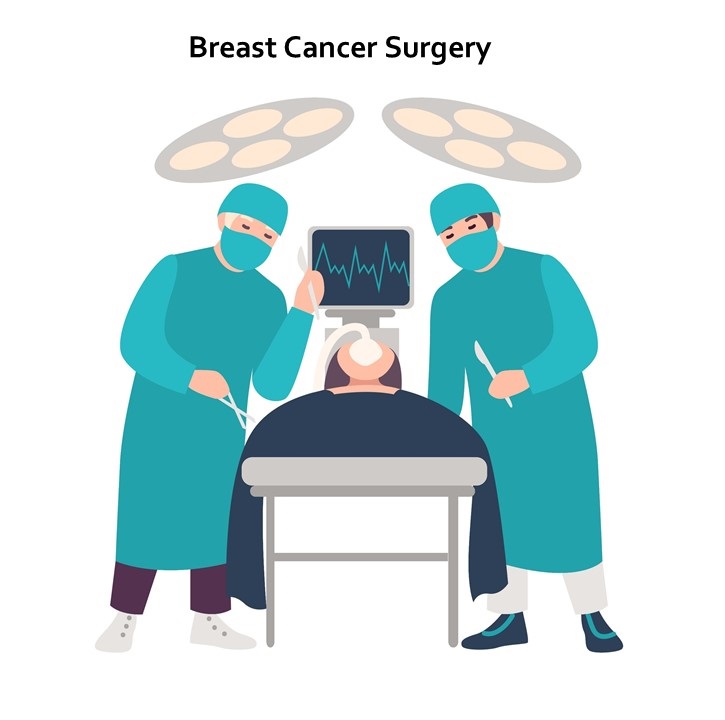 Surgery for Breast Cancer