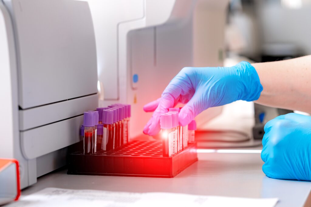 Genetic Testing For Breast Cancer